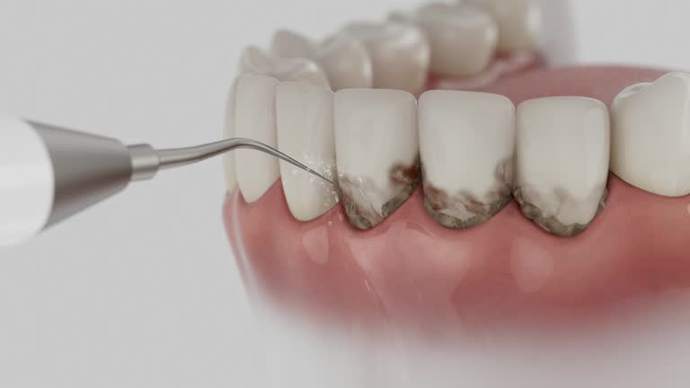 Trusted Root Canal Treatment service in Norwood, NC - Dentist Open Now